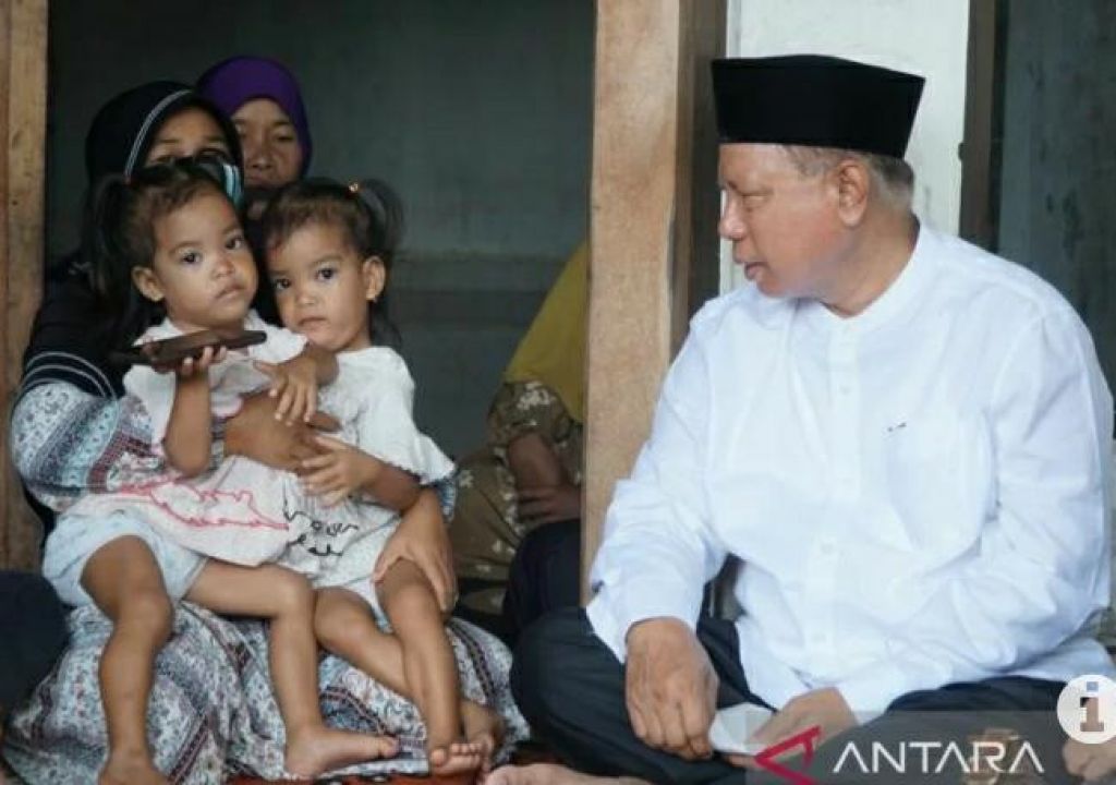 Bupati Sukiman Bakal Kawal Pemisahan Bayi Kembar Siam - GenPI.co NTB