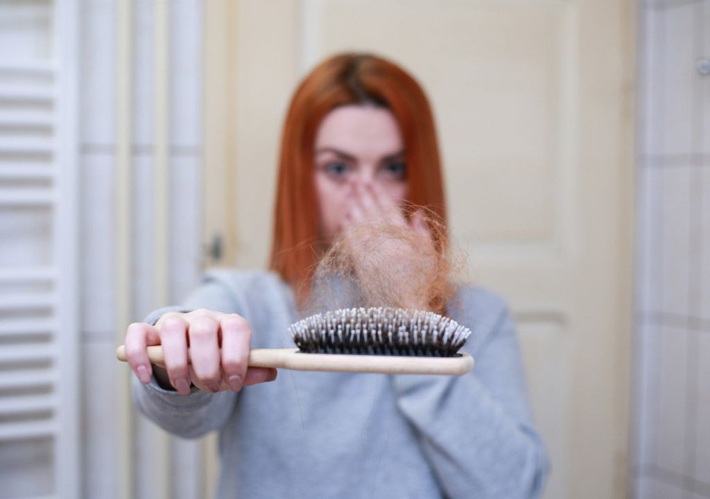 Berikut, Cara Mencegah Rambut Rontok - GenPI.co NTB