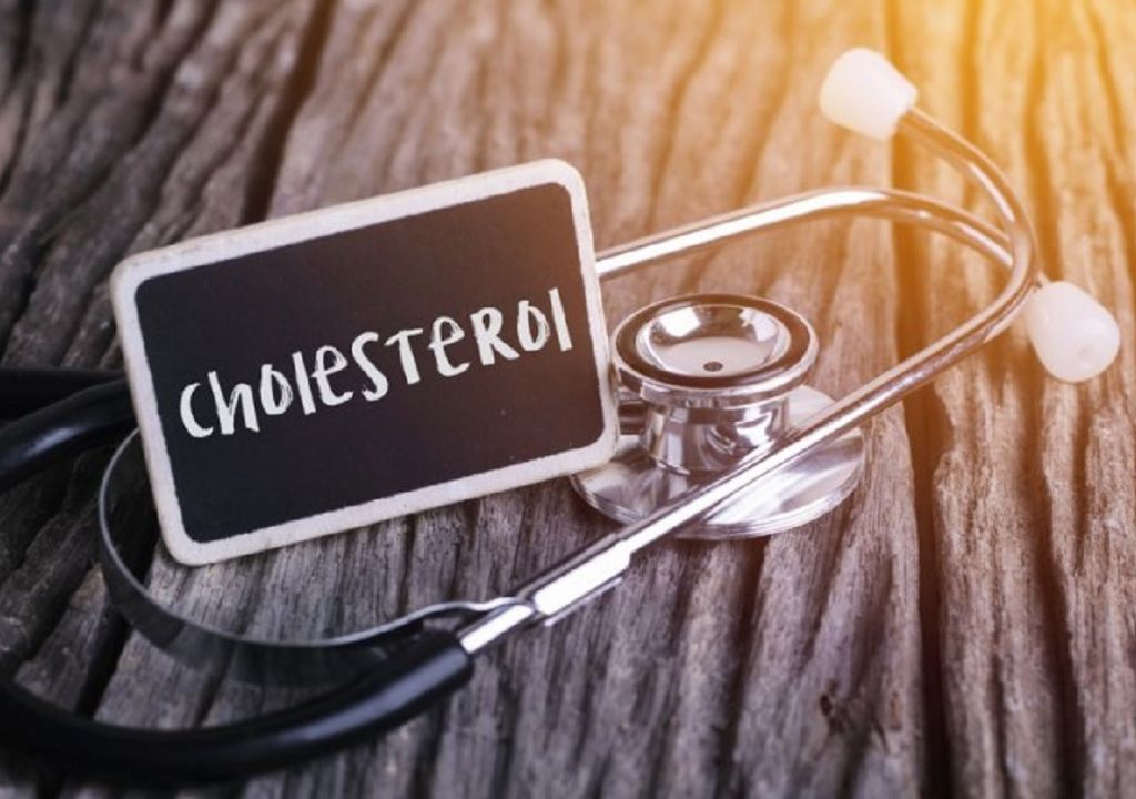 Berikut Ini 3 Pilihan Obat Penurun Kolesterol, Cek! - GenPI.co RIAU