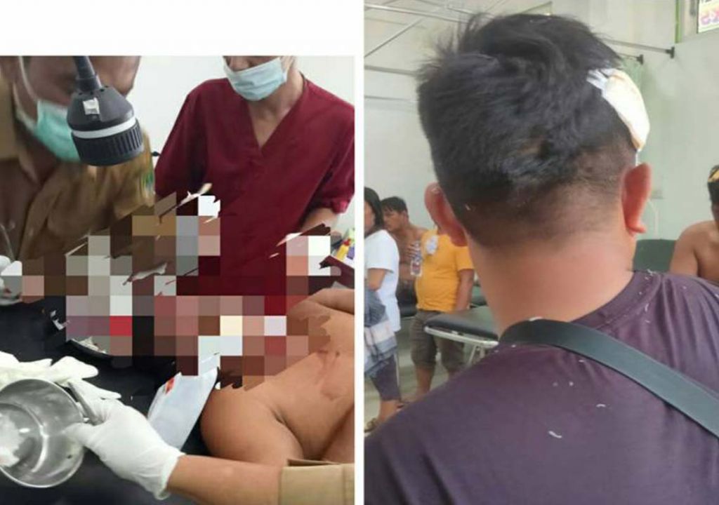Bentrokan di Rokan Hilir Riau, Sedikitnya 20 Orang Terluka - GenPI.co RIAU