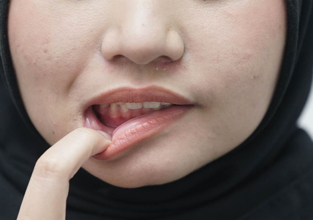 Jangan Abaikan, 10 Efek Samping Ciuman Bibir Bisa Berakibat Fatal - GenPI.co SULTRA