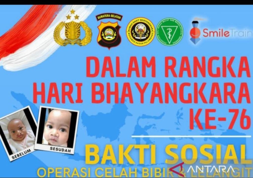 Polda Sumsel Gelar Operasi Bibir Sumbing Gratis, Catat Tanggalnya - GenPI.co SUMSEL