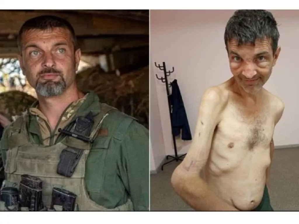 Foto Mengerikan Tentara Ukraina yang Bebas dari Penawanan Rusia, Lihat Lengannya! - GenPI.co SULTRA