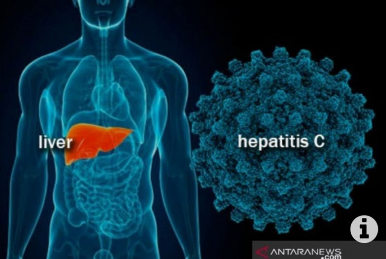 Biaya Perawatan Pasien Hepatitis Akut Ditanggung Pemerintah - GenPI.co