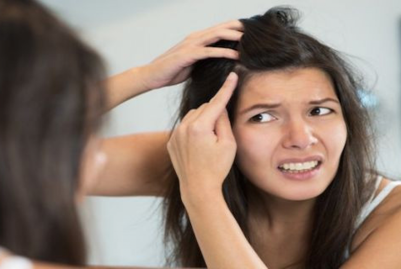 Beberapa Cara Mengatasi Rambut Uban - GenPI.co NTB