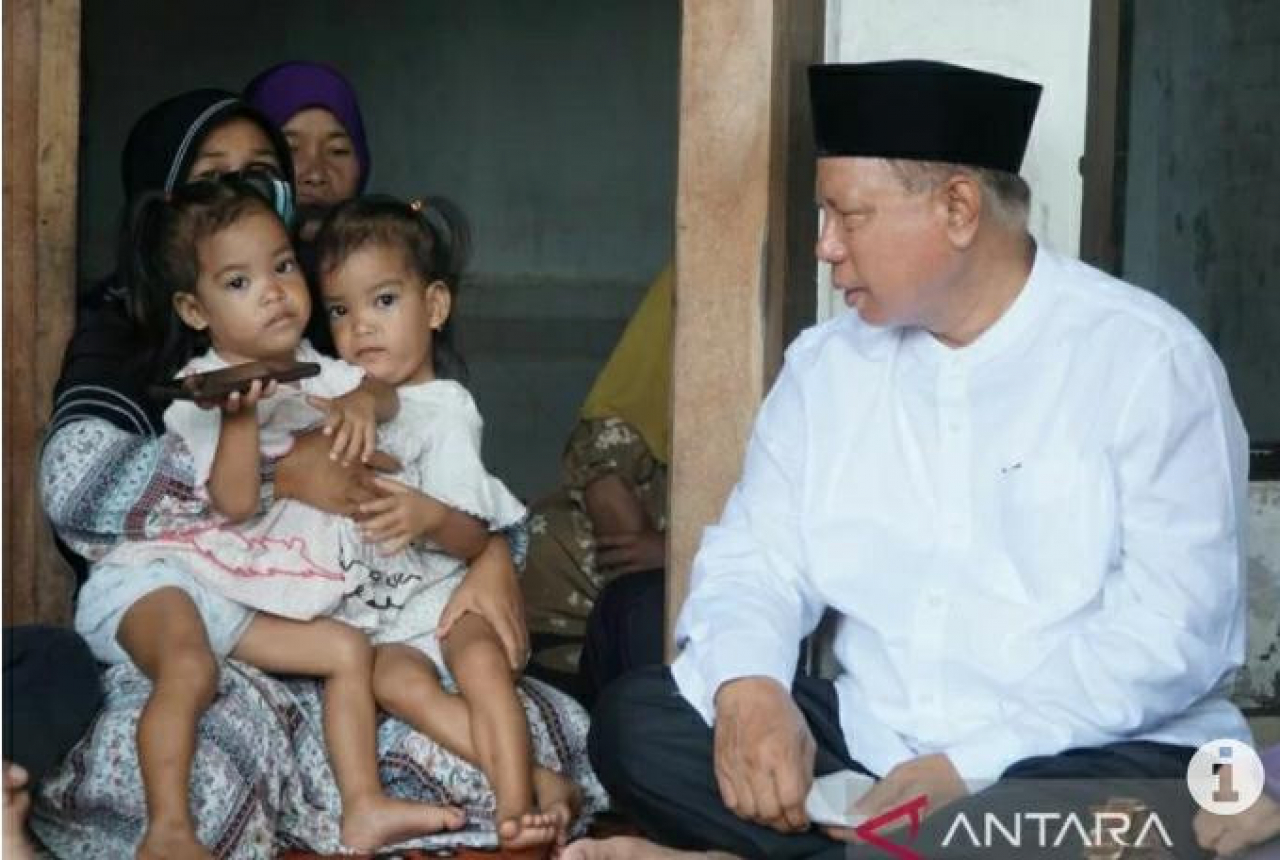Bupati Sukiman Bakal Kawal Pemisahan Bayi Kembar Siam - GenPI.co NTB