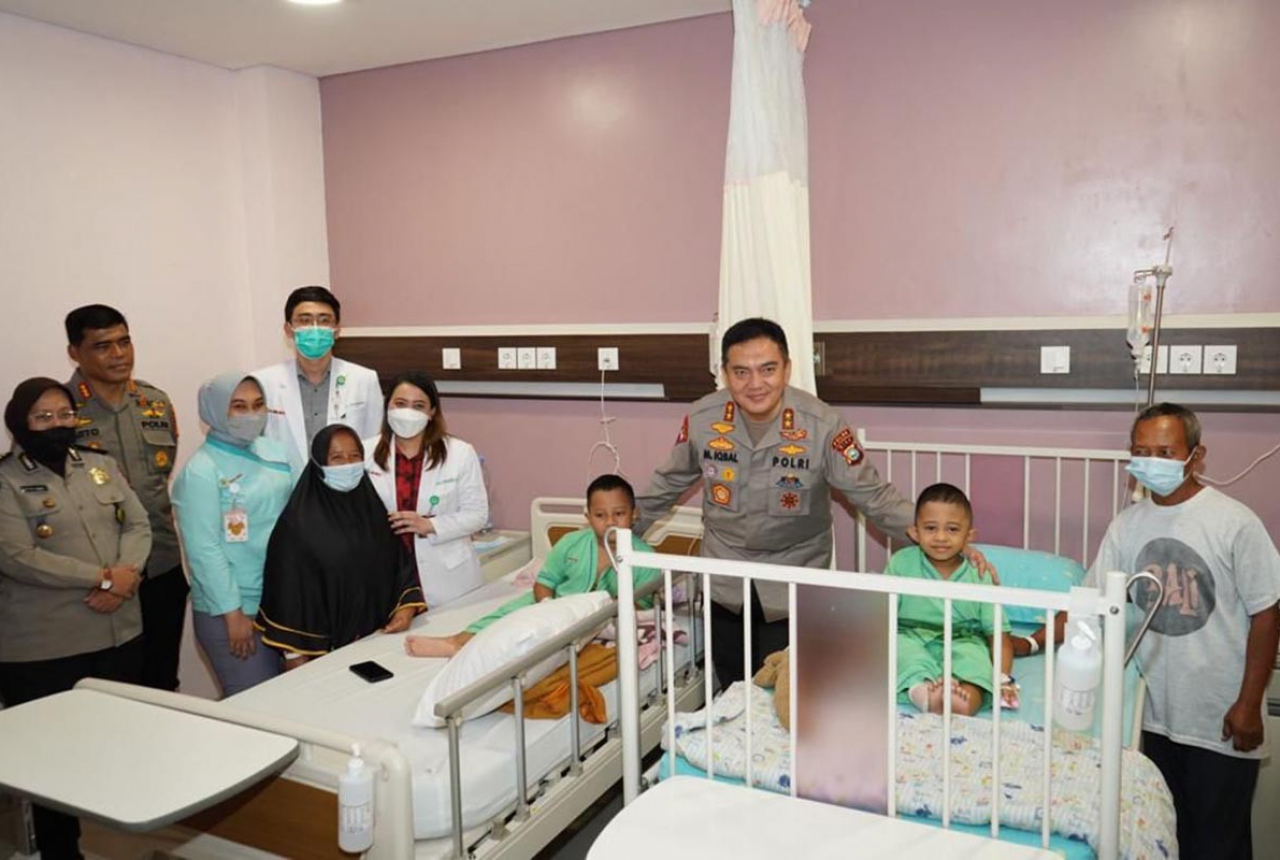 2 Bocah Rapuh Tulang, Kapolda Riau Janji Kawal Penyembuhan - GenPI.co RIAU