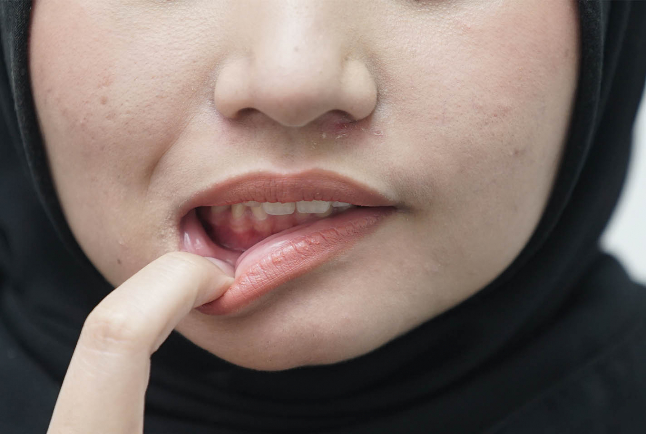 Jangan Abaikan, 10 Efek Samping Ciuman Bibir Bisa Berakibat Fatal - GenPI.co SULTRA