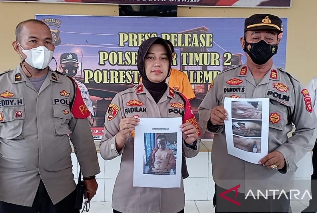 Buron 3 Tahun, Penyiram Air Keras di Palembang Akhirnya Ditangkap Polisi - GenPI.co SUMSEL