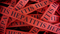 Cegah Hepatitis Akut Misterius, Epidemiolog Beri Arahan ke Warga - GenPI.co