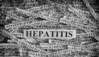 Kasus Hepatitis Akut Terbanyak dari DKI Jakarta, Kata Kemenkes - GenPI.co