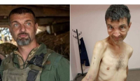 Foto Mengerikan Tentara Ukraina yang Bebas dari Penawanan Rusia, Lihat Lengannya! - GenPI.co