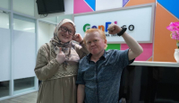 Komunitas Albino Indonesia Jadi Wadah Support System Albinisme - GenPI.co