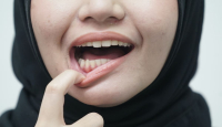 Ini Cara Jaga Kesehatan Gigi dan Mulut Selama Puasa - GenPI.co Jateng