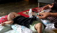 Farhan, Bayi 5 Bulan di Sumut Alami Jantung Bocor - GenPI.co Sumut