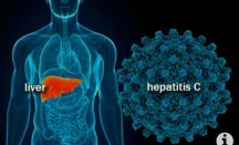 Biaya Perawatan Pasien Hepatitis Akut Ditanggung Pemerintah - GenPI.co