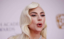 Lady Gaga Pernah Menderita Nyeri Sendi, Kenali Tanda Kekurangan Vitamin D - GenPI.co