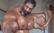 Begini Akhir Hidup Pria Brasil dengan Otot Palsu Hasil Suntikan - GenPI.co
