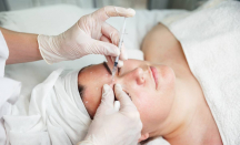 Prosedur Botox dan Filler Diperketat, Skotlandia Perangi Klinik Kecantikan Abal-Abal - GenPI.co
