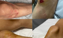 Viral! Tegur Tetangga Main Drum, Pria di Jakarta Barat Dianiaya, Saling Lapor Polisi - GenPI.co