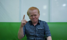 Trio Albino Berharap Bisa Sukses Jadi Aktor - GenPI.co