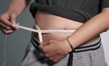 Gen Pipple, ini Dampak Obesitas Pada Kesehatan Tulang - GenPI.co NTB