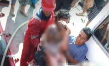 Kecelakaan Kerja di Bengkalis, 2 Karyawan PT BDP Kritis Luka Bakar - GenPI.co Riau