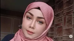 Wajah Bikin Minder, Rency Milano Habiskan Rp 800 Juta demi Operasi Plastik - GenPI.co