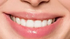 Hilangkan Karang Gigi Pakai Garam, Begini 3 Cara Mudahnya - GenPI.co BANTEN