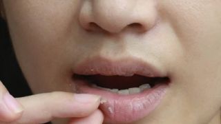 Simak Cara Mengatasi Bibir Pecah-Pecah - GenPI.co
