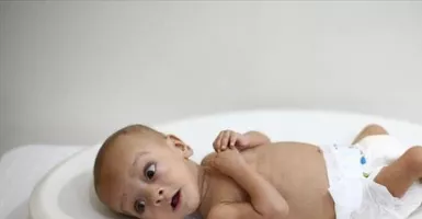 3 Langkah Perbaikan Gizi untuk Bayi Stunting, Catat Moms!
