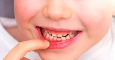 Treatment Laser Untuk Rapikan Gigi Gingsul, Hasilnya Memuaskan