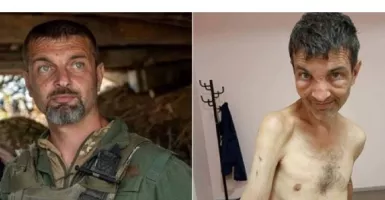 Foto Mengerikan Tentara Ukraina yang Bebas dari Penawanan Rusia, Lihat Lengannya!