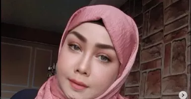 Wajah Bikin Minder, Rency Milano Habiskan Rp 800 Juta demi Operasi Plastik