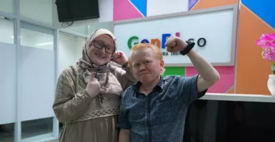 Komunitas Albino Indonesia Jadi Wadah Support System Albinisme