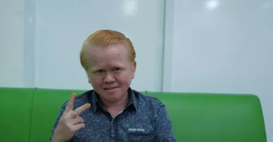 Kisah Trio Albino dan Tantangannya Menghadapi Dunia Keaktoran