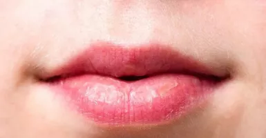 Dokter Kulit: Menjilat Bibir Kering saat Puasa Berdampak Buruk