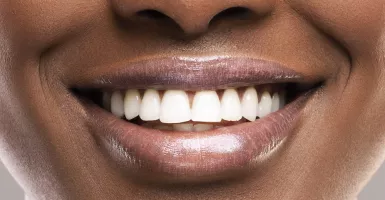Percaya Nggak Kalau Makan 3 Buah Ini Bikin Gigi Lebih Putih?