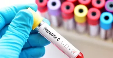 5 Aktivitas Ini Tidak Membantu Menyembuhkan Penyakit Hepatitis
