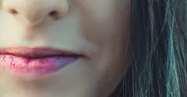 Jaga Kesehatan Bibir Saat Puasa dengan 5 Langkah Mudah Ini