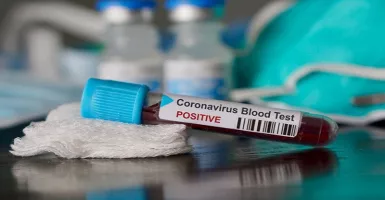 Kabar Baik, Virus Corona Berakhir Mei di Indonesia, Asal...