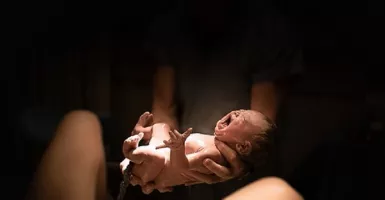 Tenang Bun, Gangguan Mata Pada Bayi Prematur Dapat Diatasi