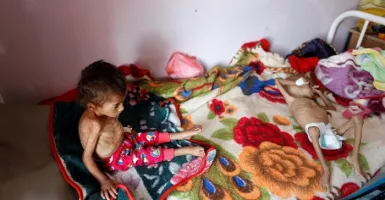 Gawat, Perang Yaman Buat 16 Juta Orang Bisa Mati Kelaparan
