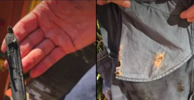iPhone X Meledak di Kantung Celana Seorang Pria, Mengerikan!