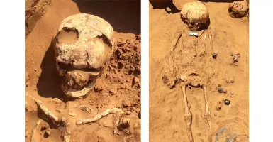 Arkeolog Temukan Tulang Prajurit yang Alami Malapraktik