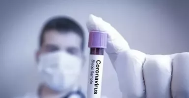 Luar Biasa... Virus Corona Bisa Sembuh Dengan Obat Oplosan Ini
