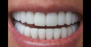 Gigi Terlihat Kuning dan Bau? 5 Cara Alami ini Dijamin Solusinya