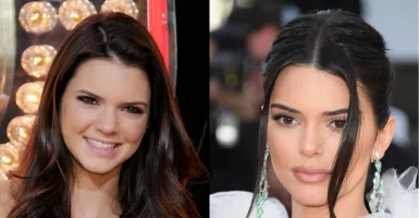 Dulu Polos, Lihat Perubahan Wajah Kendall Jenner Setelah Oplas