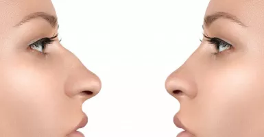 4 Cara Receh Bikin Hidung Mancung Alami Tanpa Oplas