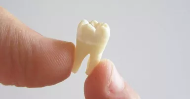 Ikuti 5 Cara ini Agar Gigi Kuning Kamu Kembali Putih